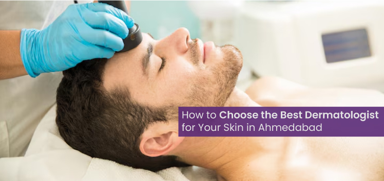 Best dermatologist in Ahmedabad for Skin