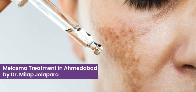 skin specialist in Ahmedabad