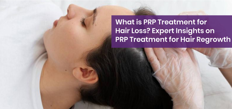 What is PRP Treatment for Hair Loss
